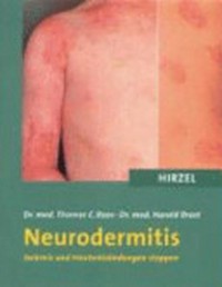 Neurodermitis: Juckreiz und Hautentzündungen stoppen